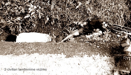 two civlian landmine victims